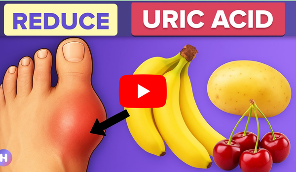 10 Morning Foods To Reduce Uric Acid To Prevent Gout