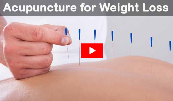 Acupuncture for Weight Loss