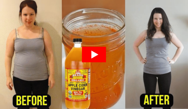 how much apple cider vinegar for weight loss