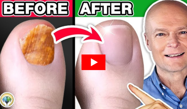 Nooro Toenail Fungus Pen