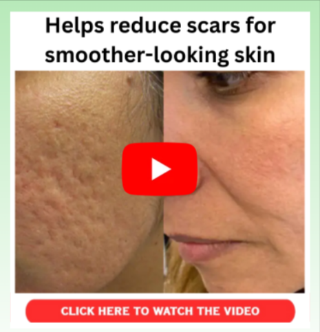Ginger Trick for Skin - Benefites