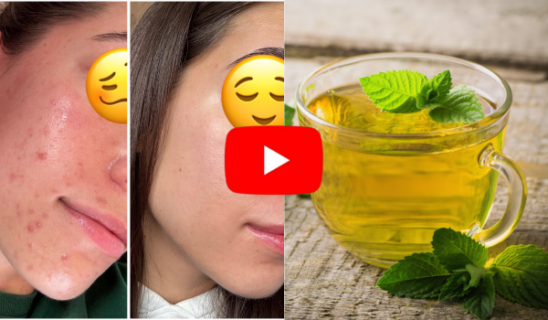 Spearmint Tea for Acne