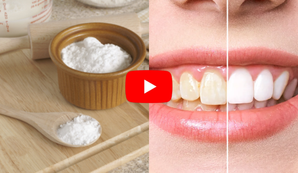 Baking Soda for Teeth Whitening 