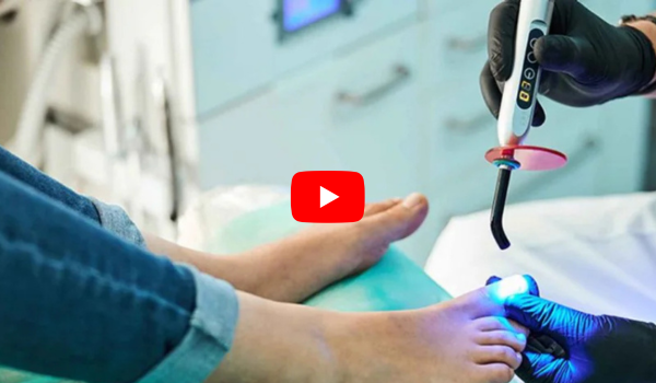 Blue Light Laser Pen for Toenail Fungus