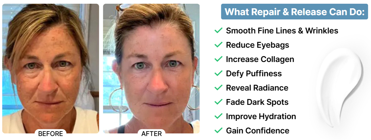 South Beach SkinLab Repair & Release Cream Benefits