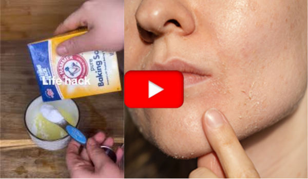 Baking Soda with Vaseline for Dry Skin