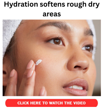 Hydration softens rough dry areas 