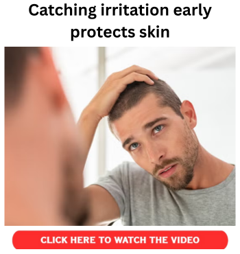 Catching irritation early protects skin
