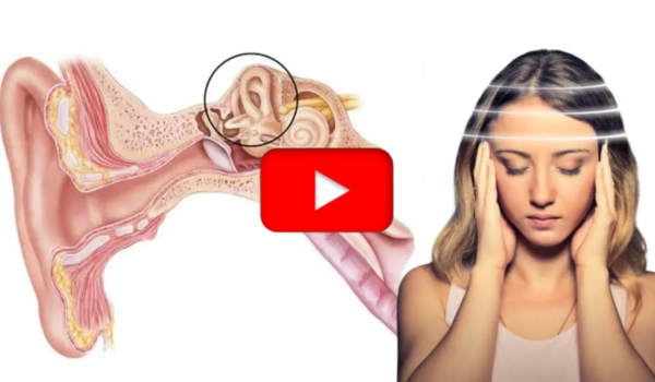 Brain Tonic for Vertigo