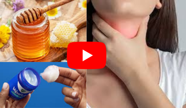 Vicks Vapor Rub And Honey For Sore Throat