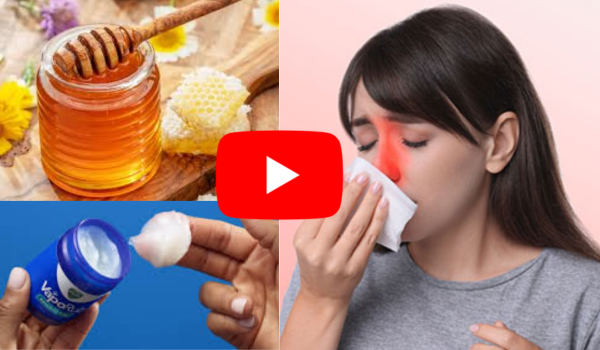 Vicks Vapor Rub and Honey for Sinus Infection
