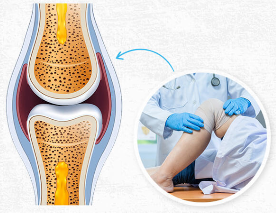 Joint Guard 360 Supplement